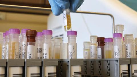 Researchers at the UW Medicine Retrovirology Lab at Harborview Medical Center work on samples from the Novavax phase 3 Covid-19 clinical vaccine trials on February 12, 2021 in Seattle, Washington. (Photo by Karen Ducey/Getty Images)